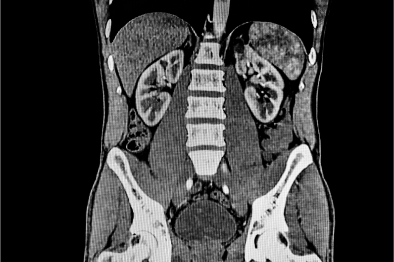 ECG Image